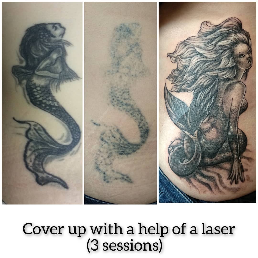 Best Tattoo Cover Ups - Start With Laser Tattoo Removal